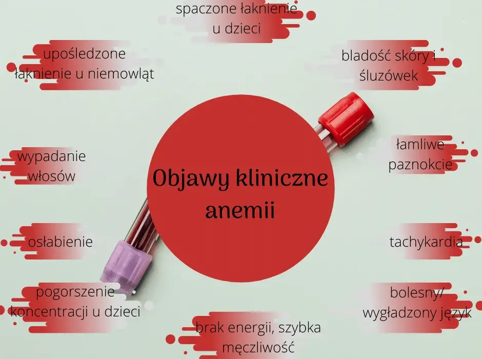 Niedobór żelaza u niemowląt objawy – jak je rozpoznać i leczyć