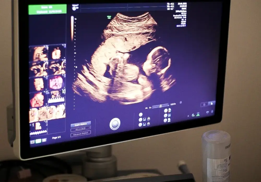 Jak się robi badania prenatalne? Poznaj metody i ich bezpieczeństwo