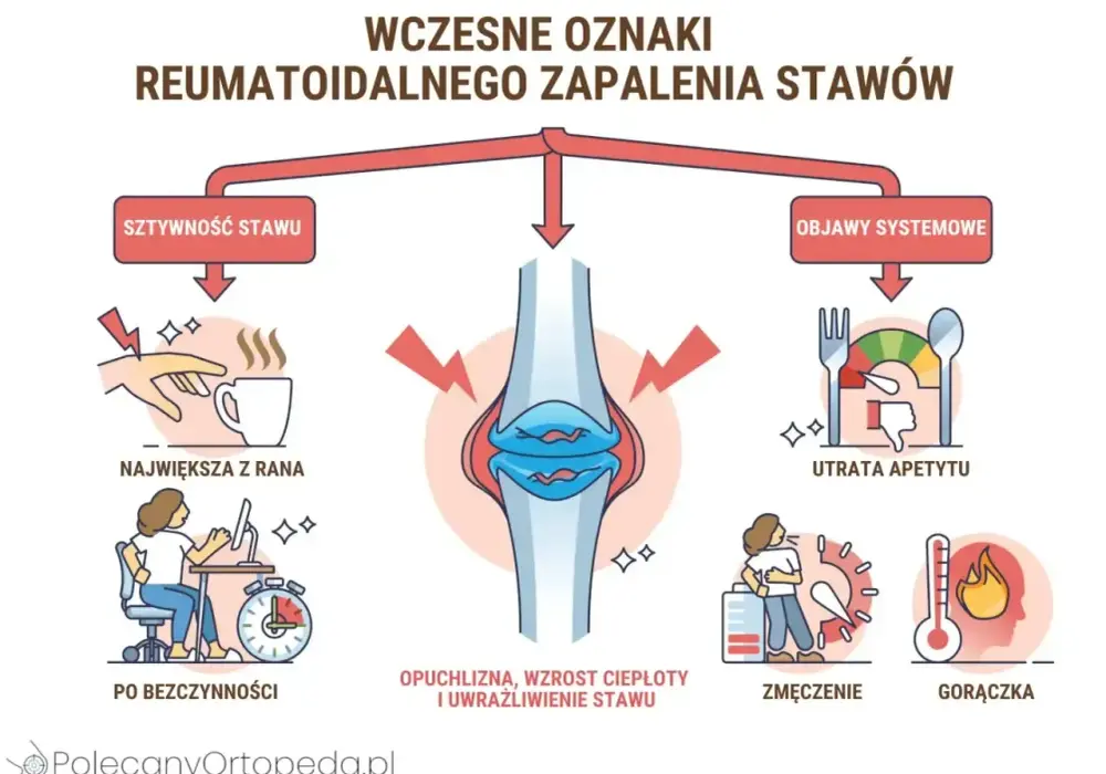 Czynnik reumatoidalny RF - Co oznacza wynik? Sprawdź!