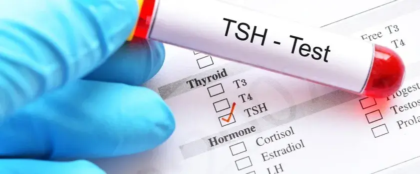 TSH badanie krwi - Wszystko co musisz wiedzieć na temat diagnostyki tarczycy