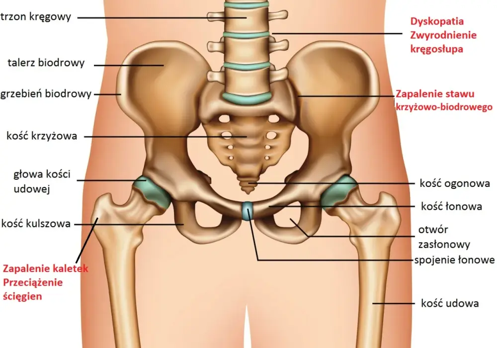 Staw biodrowy - anatomia, ból, leczenie, endoproteza. Sprawdź!