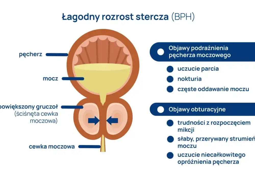 Prostata - budowa, funkcje i kiedy zaczyna dawać objawy