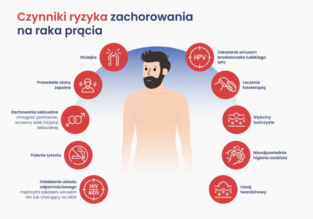 Rak prącia - objawy, leczenie i profilaktyka. Sprawdź!