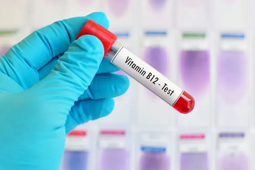 Ile kosztuje badanie witaminy B12 w Polsce? Ceny i ważne informacje
