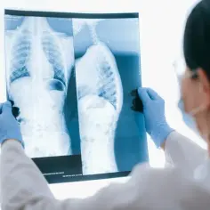 Jaki lekarz leczy osteoporozę: 5 najważniejszych specjalistów w terapii