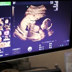 Jak się robi badania prenatalne? Poznaj metody i ich bezpieczeństwo