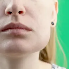 Opuchnięta twarz: przyczyny, które mogą zaskoczyć i niepokoić
