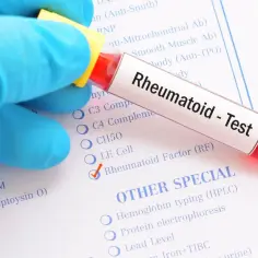 Badanie RF co to jest i jakie ma znaczenie w diagnostyce chorób autoimmunologicznych