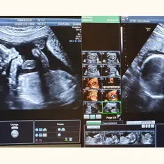 Badania prenatalne - sprawdź terminy wykonania każdego badania w ciąży
