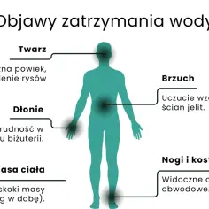 Ilustracja pokazuje objawy zatrzymania wody w organizmie: opuchliznę twarzy, dłoni, brzucha, nóg i kostek, a także gwałtowne skoki masy ciała.