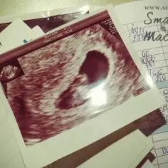 Jakie badania na początku ciąży są kluczowe dla zdrowia matki i dziecka?