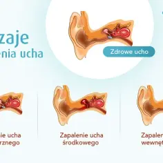 Co na ból ucha u dziecka forum: skuteczne sposoby i porady rodziców