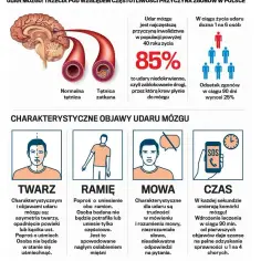 Pierwsze objawy udaru – jak je rozpoznać i dlaczego nie wolno ich ignorować?
