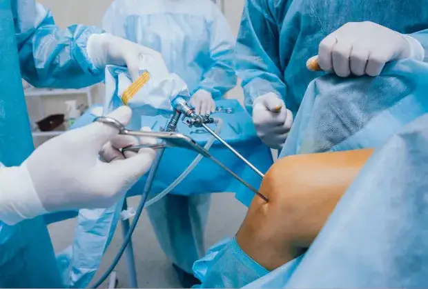 Zdjęcie Realne terminy oczekiwania na artroskopię kolana NFZ - prawdziwe kolejki