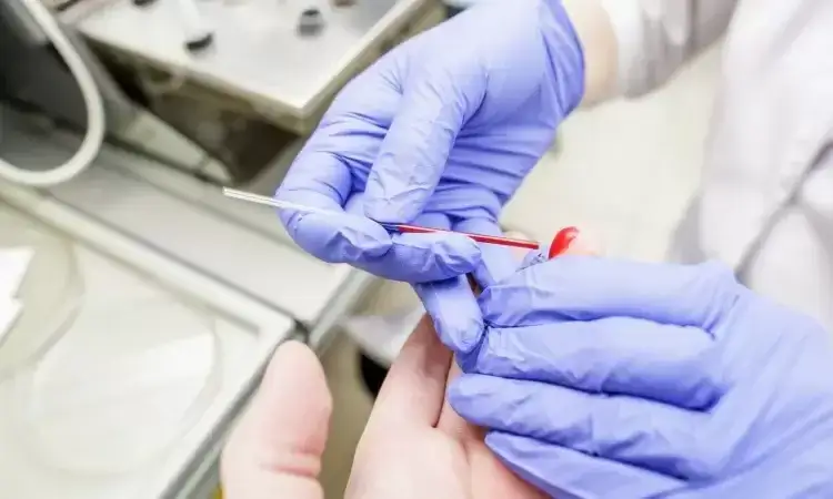 Zdjęcie MCHC w badaniu krwi - co to oznacza dla Twojego zdrowia i samopoczucia