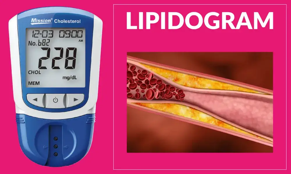 Zdjęcie Lipidogram - co to za badania i jak przygotować się do ich wykonania