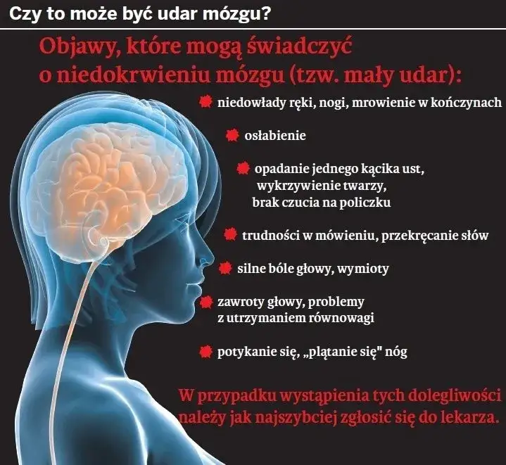 Zdjęcie Udar mózgu – przyczyny, objawy i skutki, których nie możesz ignorować