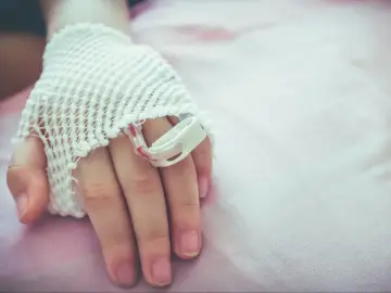 Dziecko z wenflonem na ręce. Wczesne białaczka objawy mogą być subtelne, ale ważne jest, by je rozpoznać.