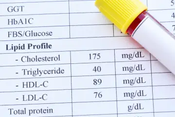 Wyniki lipidogramu wskazują na podwyższony cholesterol, co może świadczyć o hipercholesterolemii.