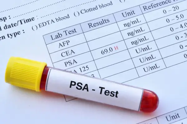PSA - Co to za badanie i dlaczego jest kluczowe dla zdrowia prostaty