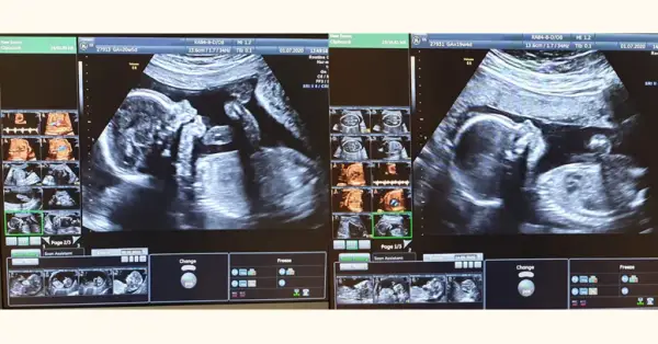 Badania prenatalne - sprawdź terminy wykonania każdego badania w ciąży