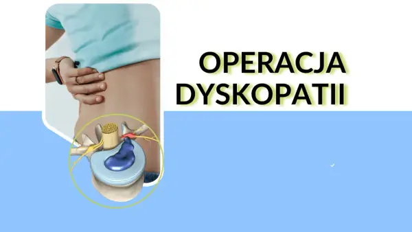 Dyskopatia - kiedy operacja, a kiedy rehabilitacja?
