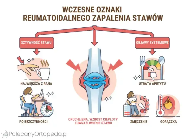Wczesne oznaki RZ: sztywność stawu (np. trudność z chwytaniem kubka), objawy systemowe: utrata apetytu, zmęczenie, gorączka.