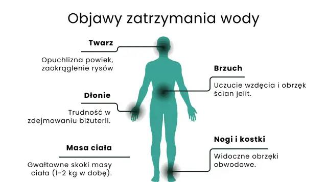 Ilustracja pokazuje objawy zatrzymania wody w organizmie: opuchliznę twarzy, dłoni, brzucha, nóg i kostek, a także gwałtowne skoki masy ciała.