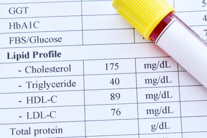 Hipercholesterolemia - Jak czytać lipidogram i obniżyć cholesterol?